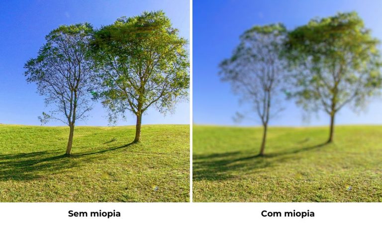 Como A Vis O De Quem Tem Miopia Central Da Vis O